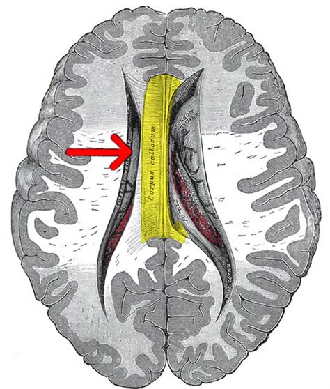 Corpus callosum .